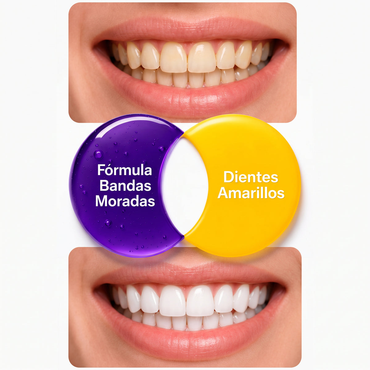 Purple whitening strips® | Kit de Tiras Blanqueadoras moradas de Acción Profunda