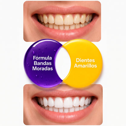 Purple whitening strips® | Kit de Tiras Blanqueadoras moradas de Acción Profunda
